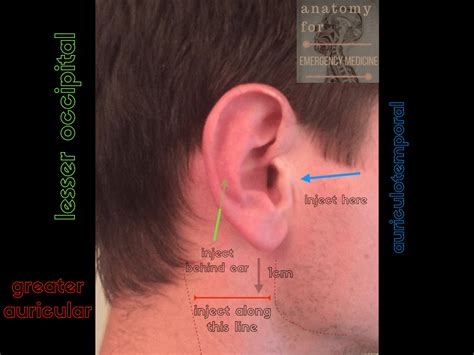 045 Sensory Innervation Of The Ear Emergency Medicine Ireland