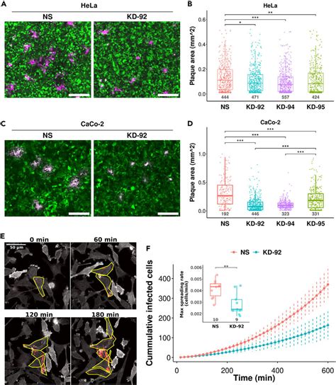 Rack Silencing Reduces Shigella Cell To Cell Spreading In Hela And