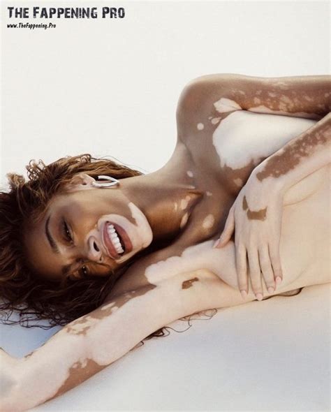 Winnie Harlow Nude 2023 11 Photos The Fappening