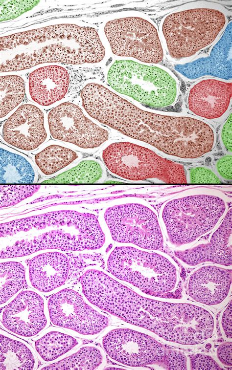 Human Seminiferous Tubules Photograph By Jose Calvo Science Photo