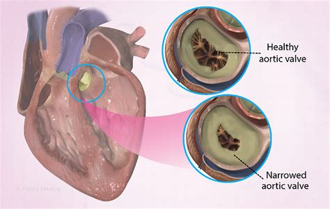 Health Condition Symptoms Causes Treatment And More