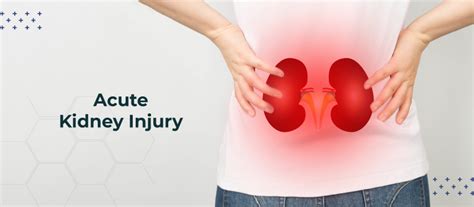 Acute Kidney Renal Injury Or Failure Signs Symptoms And Treatment Ainu