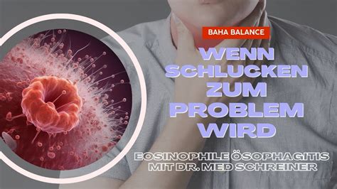 Eosinophile Sophagitis Eoe Genau Erkl Rt Vortrag Dr Philipp