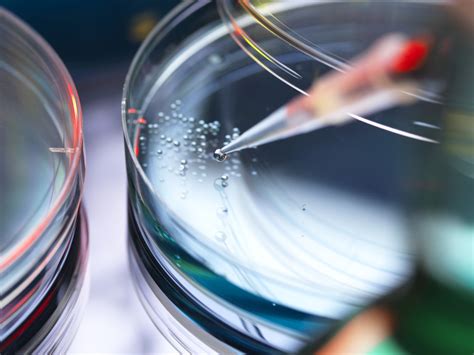 How To Identify Mold In Petri Dishes Sciencing