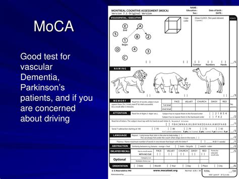 Moca test australia - sherymet