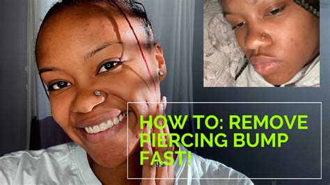 How To Get Rid Of A Piercing Bump Fast Within Weeks Or Even Days