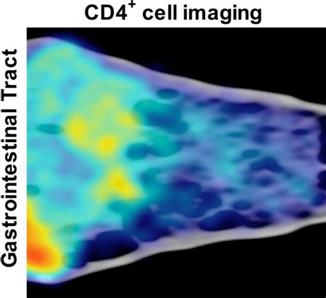 Simplifying HIV Treatment A Surprising New Lead NIH Intramural