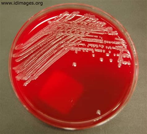 Morphology Culture Characteristics Of Salmonella Typhi S Typhi