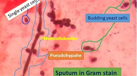 Germ Tube Test Introduction Principle Procedure Result