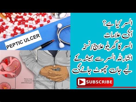 Alsar Ka Desi Ilaj Stomach Ulcer Disease Peptic Ulcer Treatment