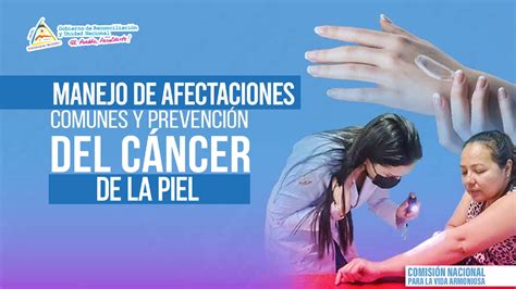 Minsa Presenta Cartilla De Prevención Del Cáncer De Piel