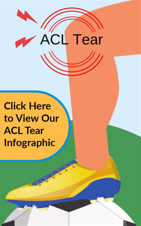 ACL Tear Infographic - Advanced Orthopaedic Centers