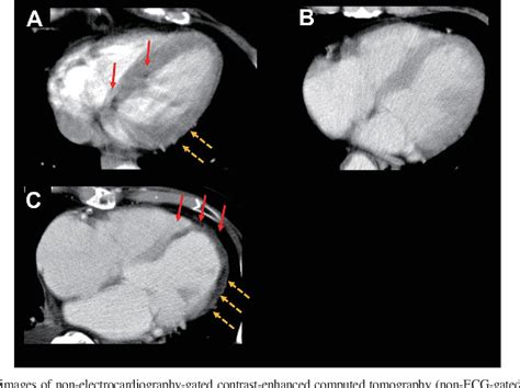 Figure From The Effectiveness Of Non Ecg Gated Contrast Enhanced