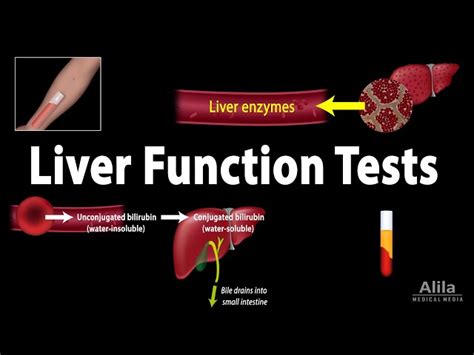 Liver Disease Types Of Liver Problems Causes And More Off