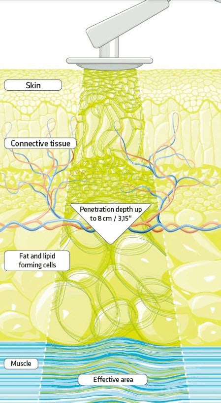 Deep Tissue Oscillation Therapy in Long Island | Marjorie Brook, LMT