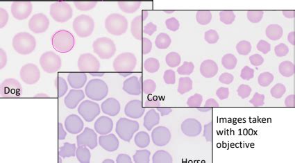 Hematology Rbc Morphology Flashcards Quizlet