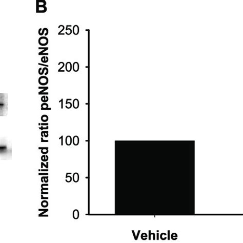 Phosphorylation Of ENOS After Treatment Of Bovine Pulmonary Artery