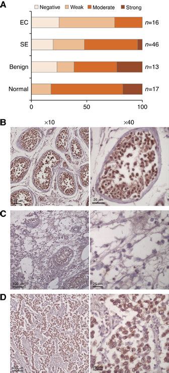 Immunohistochemistry Of Usp13 On Testicular Tissue Ec And Seminoma