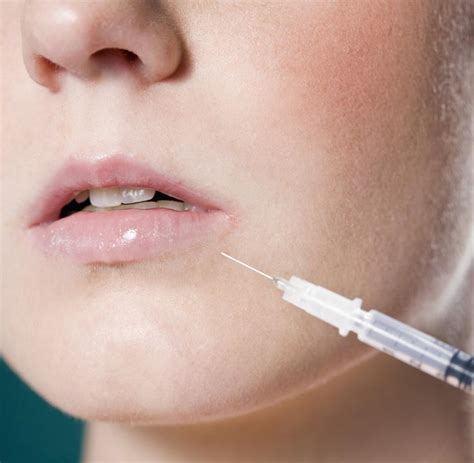 Muskelentspannung Botox hilft gegen extremes Zähneknirschen WELT