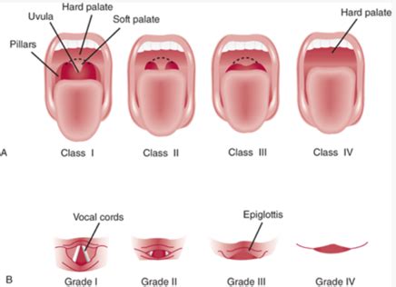 Preanesthetic Preparation Flashcards Quizlet