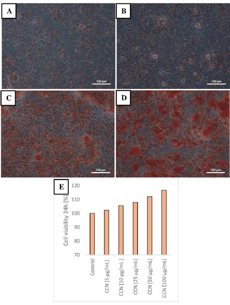 Alizarin Red Staining For Mineralization The Calcified Nodules