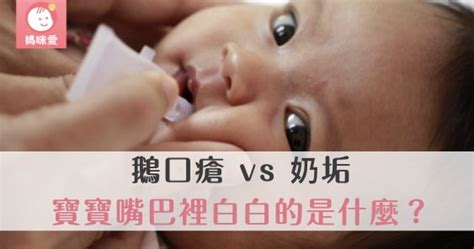 鵝口瘡 Vs 奶垢｜寶寶嘴巴裡白白的是什麼？ 育兒文章｜媽咪愛