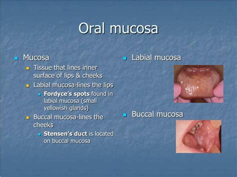 Ppt Landmarks Of The Face And Oral Cavity Powerpoint Presentation Free Download Id 5535488