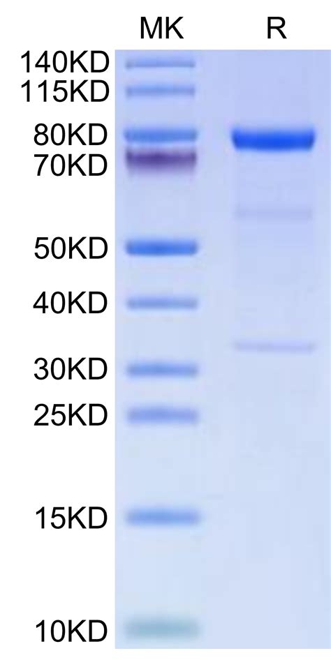 Human Complement Component C1s Protein Accession P09871 江苏沃尔森生物科技有限公司