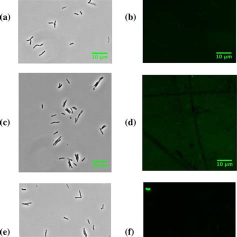 Phase Contrast And Fluorescence Microscopy Of M Smegmatis Cells