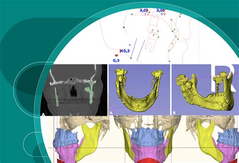 Craniofacial Research