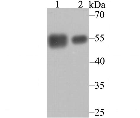 Calreticulin Monoclonal Antibody 7b1 Ma5 45067