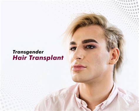 Transgender Hair Transplant Hair Restoration Clinic For Lgbt Individuals