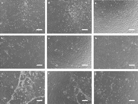 Angiogenesis In Vitro In Human Dermal Microvascular Endothelial Cells Download Scientific