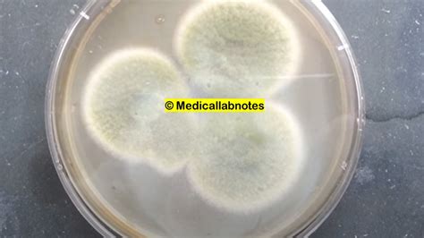 A Fumigatus Introduction Morphology Pathogenicity Lab Diagnosis