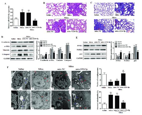 Down Regulated Mir P Attenuates Silica Induced Pulmonary Fibrosis