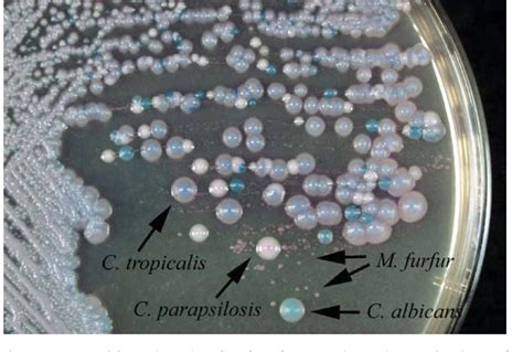 Figure 2 From Vital Growth Factors Of Malassezia Species On Modified