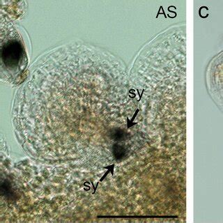 Spatiotemporal Expression Pattern Of TfSTK3 In Mature Ovules Detected