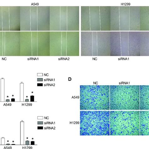 Knockdown Of USP8 Inhibited The Cell Cycle Progression Of Lung Cancer