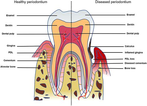 Concise Review Periodontal Tissue Regeneration Using Stem Cells