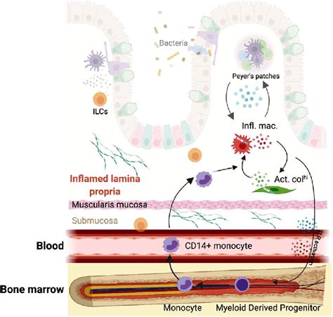 Infiltrating Monocytes Sustain Plasticity In The Inflamed Gut