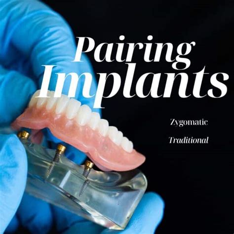 Pairing Zygomatic Implants With All On Treatment