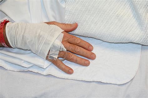 hand   cannula stock photo  image  arm australia