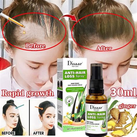 Ginger Hair Growth Essence Oils Anti Hair Loss Treatement Fast Growing