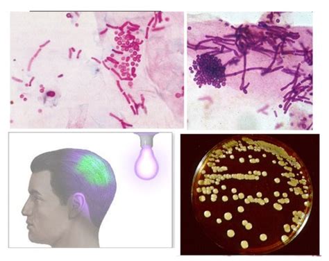 Lecture 16: Fungal Pathogens I Flashcards | Quizlet