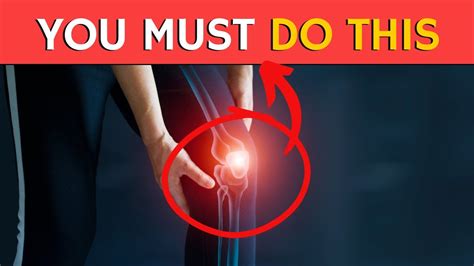 Best Vitamins For Arthritis Not Vitamin D Youtube