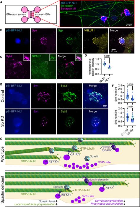 Spastin Locally Amplifies Microtubule Dynamics To Pattern The Axon For