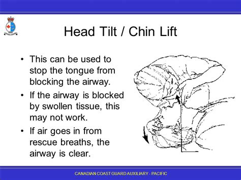 First Aid 2 Airway Emergencies Ppt Download