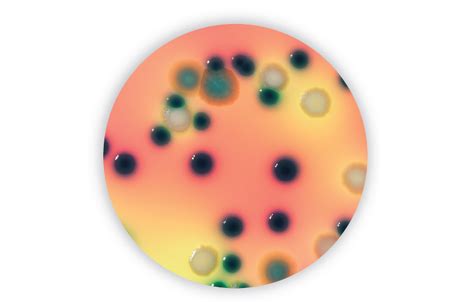 Escherichia coli O157:H7 | Food Science | Bio-Rad