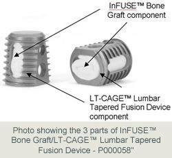 Medtronic Infuse Bone Graft Device Lawsuit