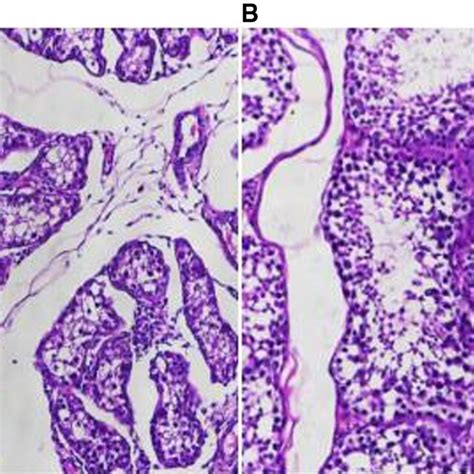 Observation Of Pathological Results A HE Staining Of Testicular